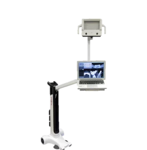 Endodoncia Guiada por Computador